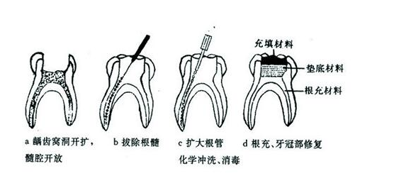 成都義齒產業在國際市場上的地位如何？? | 成都義齒廠家