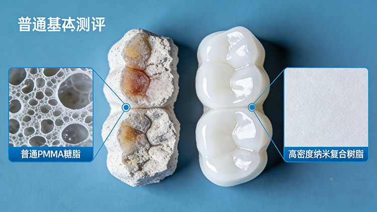 義齒發黃、松動、有異味？成都義齒廠家解析三大問題根源與應對方案